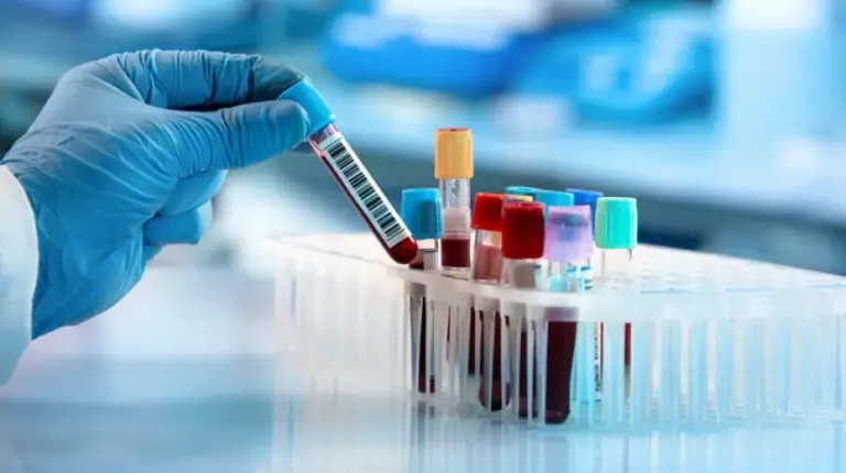 Mandimycyna – nowy potencjalny środek przeciwgrzybiczy zabija grzyby oporne na wiele leków - INFBusiness