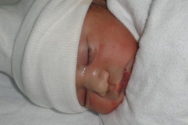 ByHeart wycofuje wszystkie mleka modyfikowane dla niemowląt z powodu epidemii botulizmu