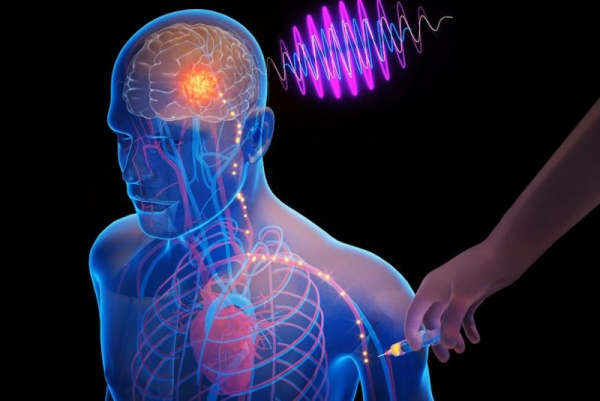 Naukowcy z MIT opracowują wstrzykiwalny chip na zaburzenia mózgu