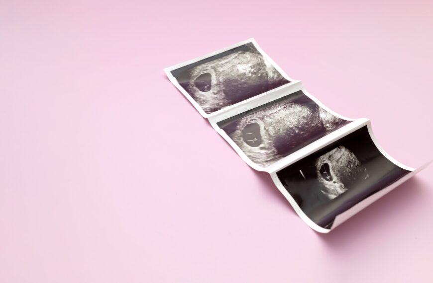 Redukcja płodów w ciążach mnogich. Głośny przypadek od Aborcyjnego Dream Teamu.